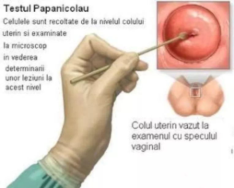 O tanara a fost mutilata in urma unui test Papanicolau